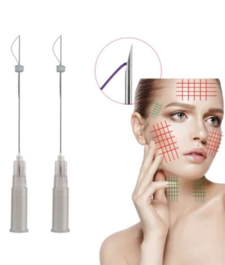 Alpha Surgicals Mono PDO Thread 29G-38mm for skin rejuvenation and wrinkle treatment